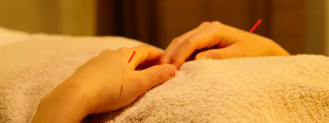 刺絡施術