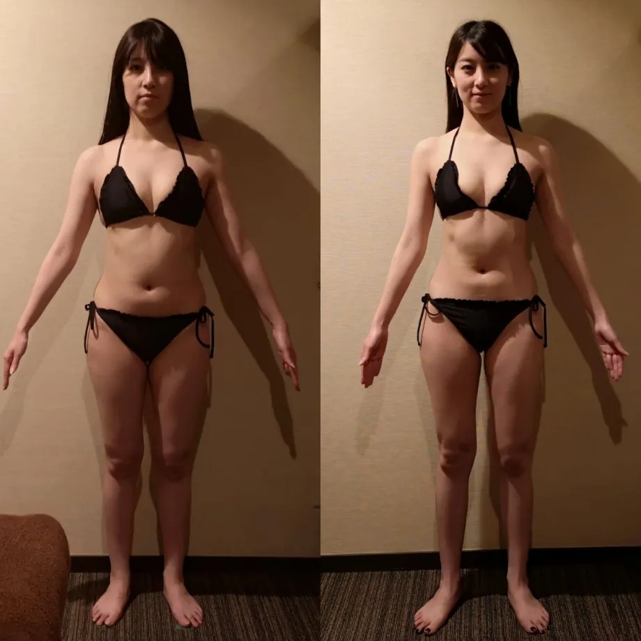 ダイエット鍼の効果02